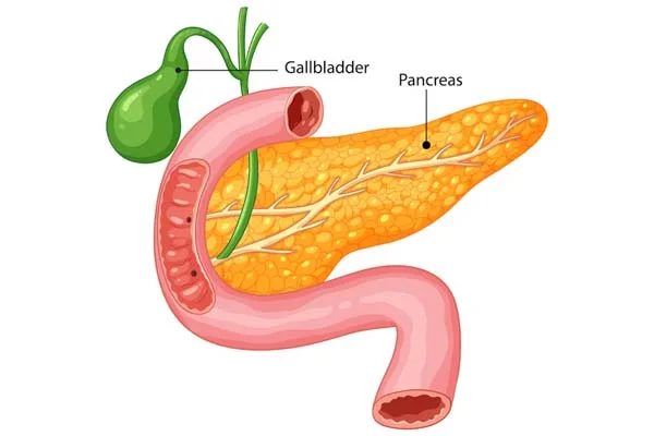 ERCP