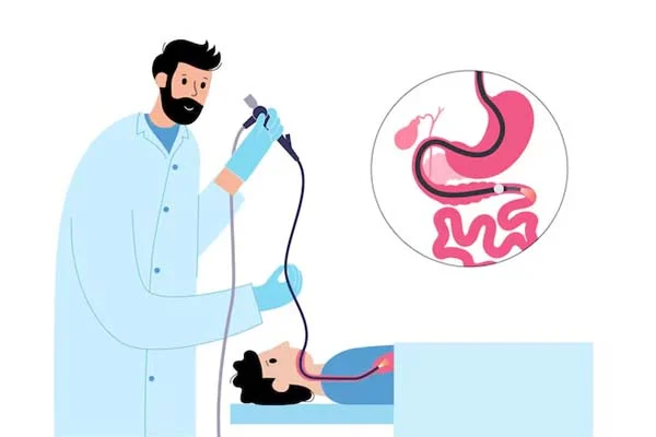 Upper GI Endoscopy